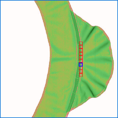 Scanned image ofan X-ray protective clothing after computer processing (three colors correspond to three area s of the thickness of the lead equivalent) 