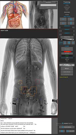 LINEV Group DRUGUARD - Swallowed Drugs Detection Software Interface