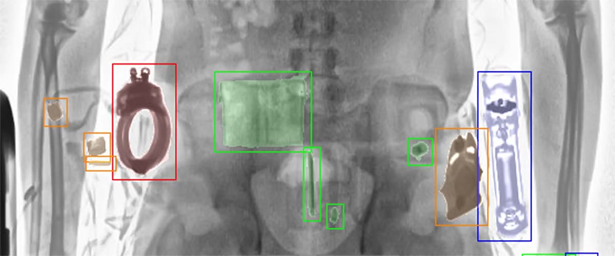 LINEV Group bodyscanner systems AI detection software